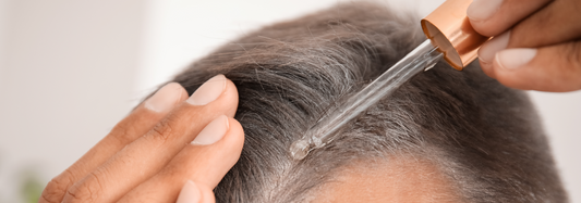 Hair Shedding vs. Hair Loss: Key Differences