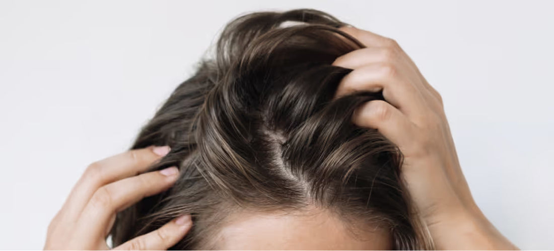 Managing an Oily Scalp Naturally