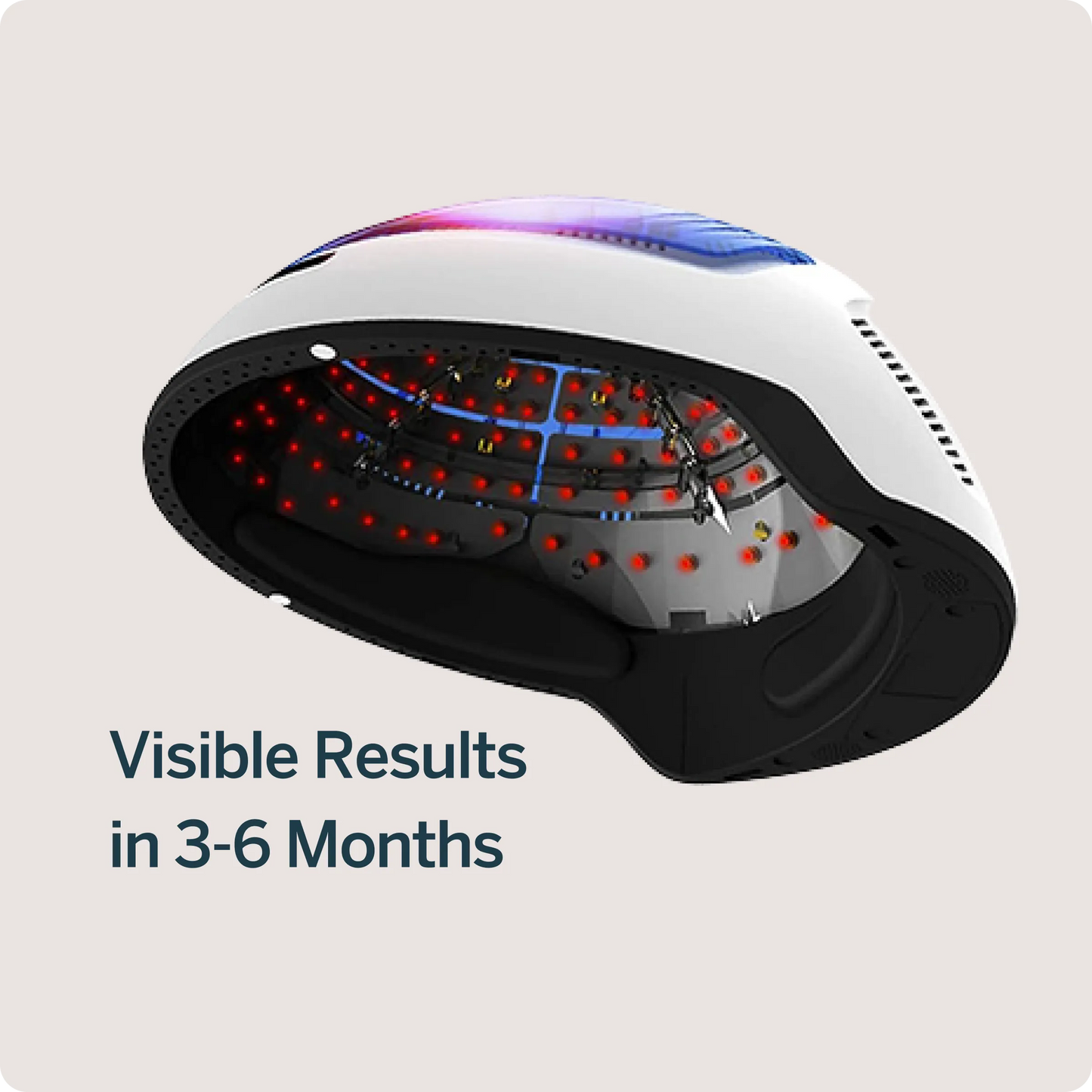 Advanced Laser Helmet Hair Growth System